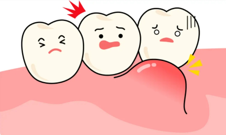 青少年牙髓炎怎么治疗好的快？