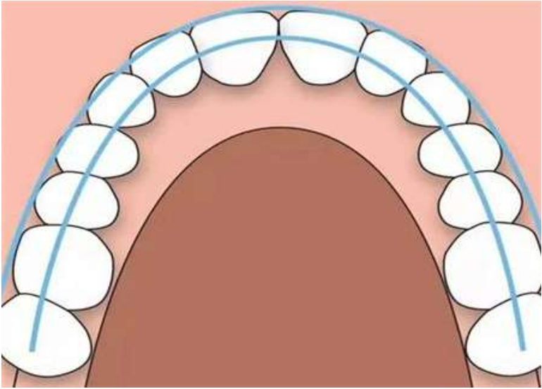 牙弓不正怎么办?