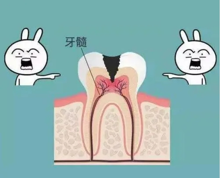 儿童做根管治疗是治疗哪些牙齿疾病