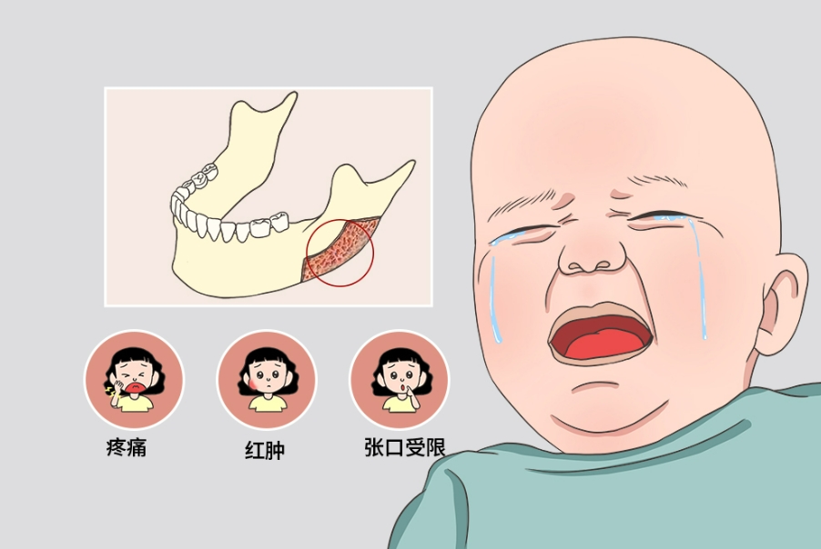 颌骨发育不良什么原因造成的,可以预防吗？