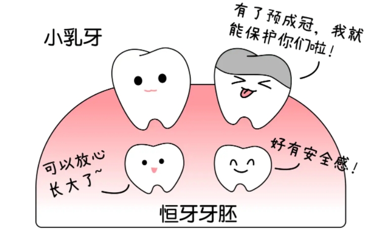 儿童预成冠有哪些种类？